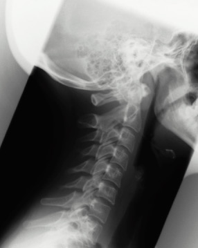 Spinal Cord Research